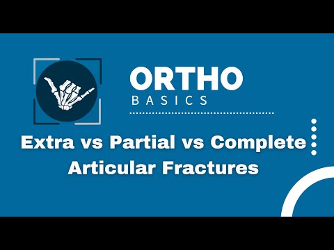 Ortho Basics: Extra vs Partial vs Intra/Complete Articular Fractures