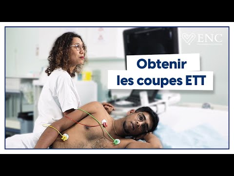 Tuto ENC : comment obtenir les incidences en ETT ?