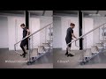David C-Brace Gait Comparison Video | Ottobock