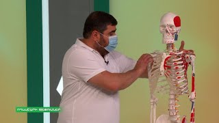 Առաջին օգնություն. Սկոլիոզ