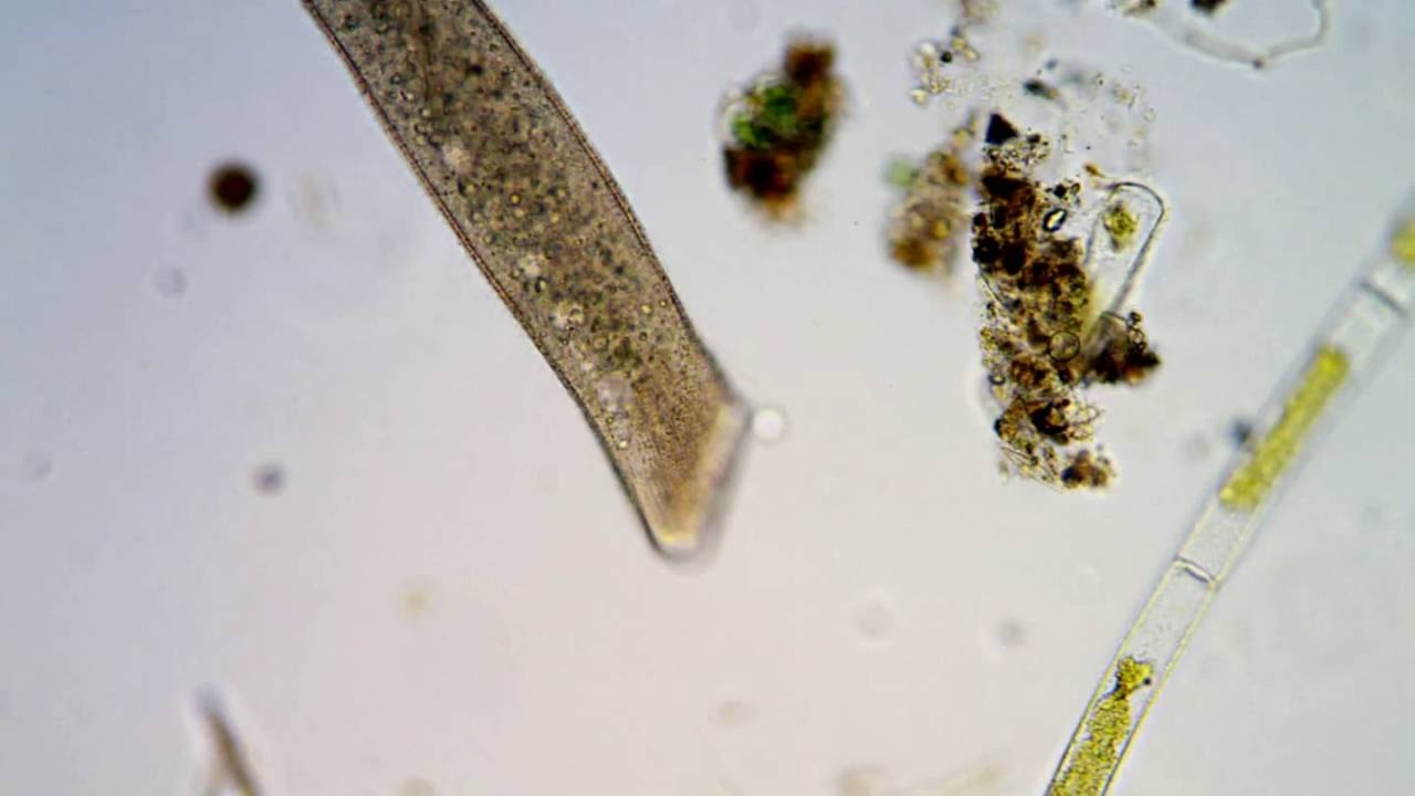 <em>Supraspathidium</em> sp. (Spathidiid ciliate)