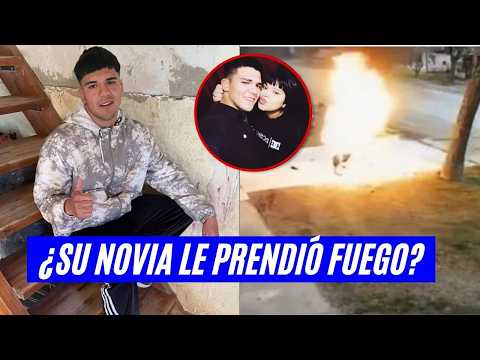 Murió con el 95% de su cuerpo quemado: ¿Su novia le prendió fuego?