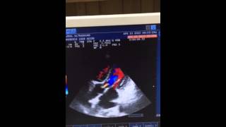 Echo protocol global