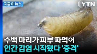 '살 파먹는' 끔찍한 벌레, 결국 인간까지...감염 사례 첫 확인 [지금이뉴스] / YTN