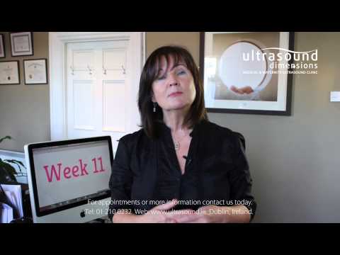 11 Weeks Pregnant - Your 11th Week Of Pregnancy