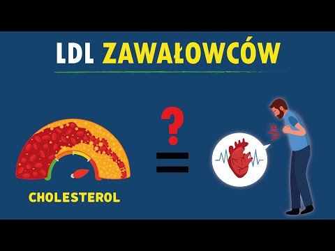 Oto lipidogram ZAWAŁOWCÓW – ich LDL, TG i HDL Cię zszokują