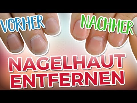 Die Cremes vom Ekzem bei der Schwangerschaft Die Salbe von der Schuppenflechte des Bildes