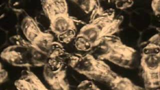 Controlled Bleeding &quot;Bees (Parts 1 - 6)&quot; Video