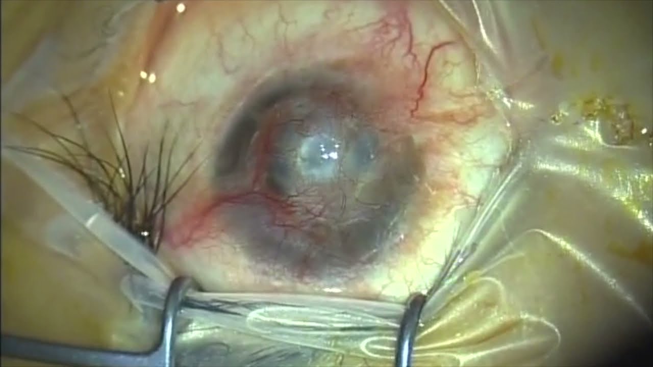 Kristian Alfonso Vazquez Romo-43