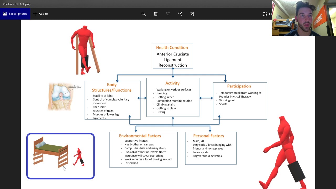 ICF Model for ACL reconstruction
