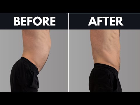 Fixing Anterior Pelvic Tilt is easy, actually.