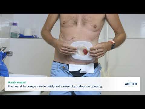 Erland Care pleister bij gebruik 2-delig systeem