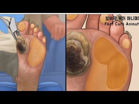 Be Surgeon in Hospital Simulator, treat patient in Foot Surgery Free Doctor Game।। 🦵 leg care।।