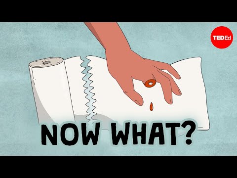 What should you do if you accidentally cut off your finger? - Jason Hoellwarth