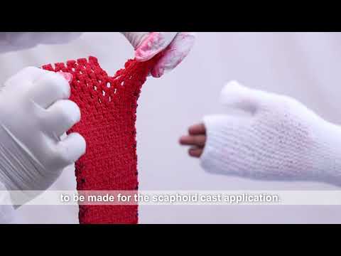 How to make a Scaphoid Cast using VENTICAST™️
