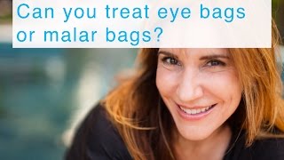 Can you treat eye bags or malar bags?