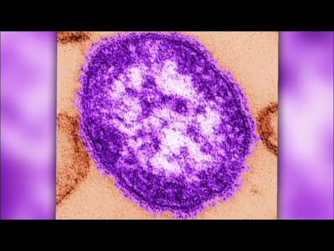 NJ Ocean County & NY Rockland County Measles Outbreak