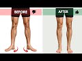 How To Correct Duck Feet Feet Turn Out 3 Step Process