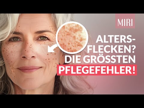 Schöne Haut Ü50: Umgang mit Altersflecken