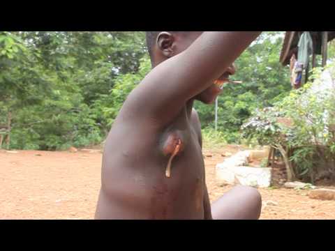 Improvising in Africa.  Warning - GROSS - Smarter Every Day 28