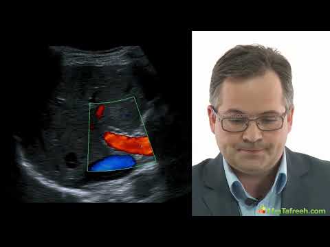 Gallbladder Ultrasound 3