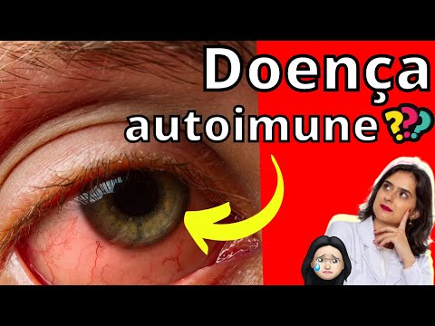 Você tem dor no olho? Olhos vermelhos pode ser doença autoimune!