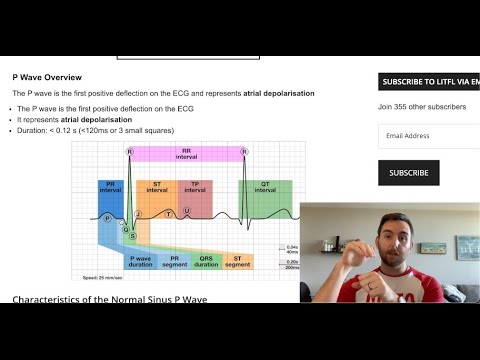 EKG 101 - "PQRST" - Part 2/7