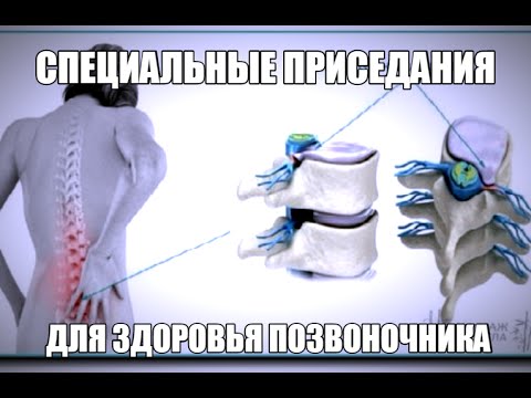 Врожденная аномалия плечевого сустава Низкочастотные токи при остеохондрозе