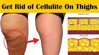How to Get Rid of Cellulite on Thighs and Bum - 7 Home Remedies to Get Rid of Cellulite on Legs
