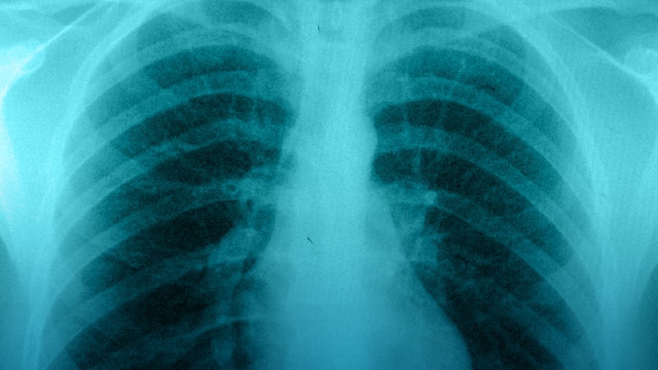 Baltazar Pech Alonso-24