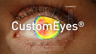 CustomEyes 라식라섹 _개인맞춤형 시력교정술