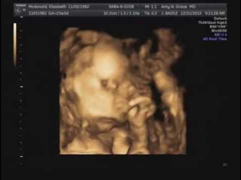 Ultrasound 12/31/2013