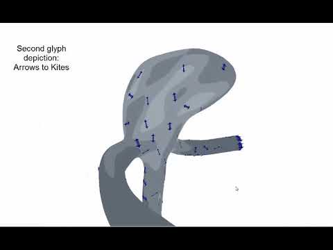 Glyph‐Based Comparative Stress Tensor Visualization in Cerebral Aneurysms