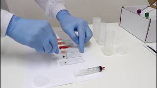 Como é realizada a técnica de esfregaço sanguíneo