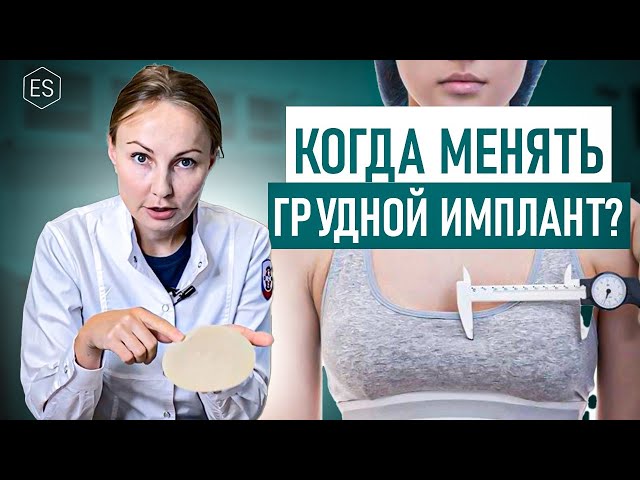 ЗАМЕНА ГРУДНЫХ ИМПЛАНТОВ. Нужно ли менять грудной имплант через 10 лет?