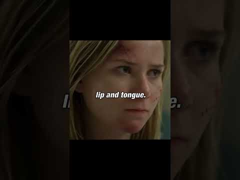 House finds a patient who can't feel #housemd #series