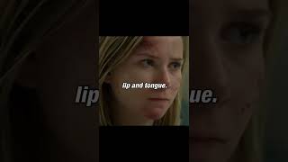 House finds a patient who can't feel #housemd #series