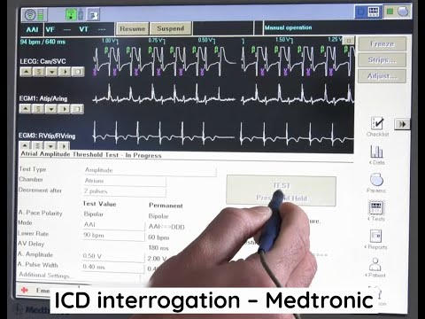 ICD interrogation - Medtronic