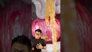 Download lagu Suka Tahan Air Kencing? mp3 Download lagu Suka Tahan Air Kencing? mp3