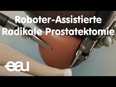 Roboter-Assistierte Radikale Prostatektomie
