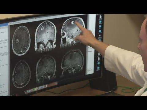 COVID-19 pandemic accelerated brain age, study shows