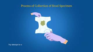 Stool Specimen Collection AFP Surveillance
