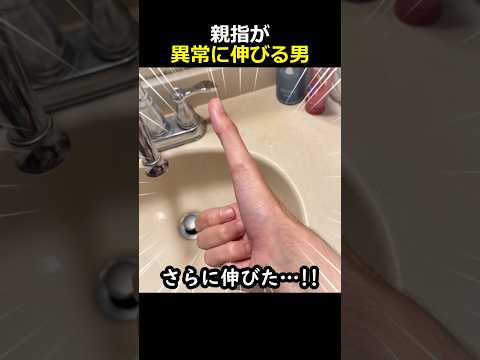 親指が異常に伸びる男