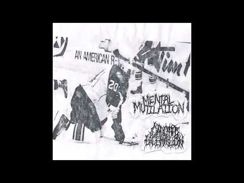 Mental Mutilation // Carotid Laceration - Split (2023)