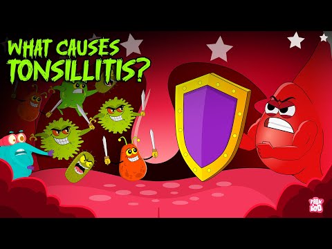 What Causes Tonsillitis? | Tonsils Symptoms & Treatments | Bacterial Infections | Dr. Binocs Show