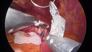 LG 27” Χειρουργικό μόνιτορ Full HD της LG, play video, 27HK510S-W, thumbnail 2