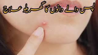 how to get rid pus filled pimples|| pus waly dano ka ilaj || how to remove pimples