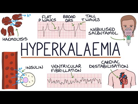 Haemolytic Uraemic Syndrome