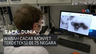 Sapa Dunia: Wabah Cacar Monyet Terdeteksi di 75 Negara