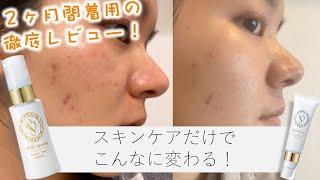 ベルブラン+ベルクイーン【お試しセット】のレビュー…唯一悪い ベルブラン+ベルクイーン【お試しセット】のレビュー…唯一悪い
